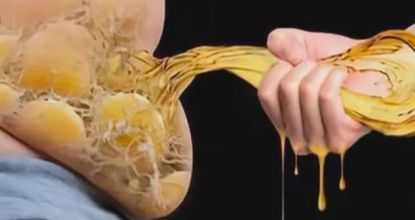 How To Lose 40.5 Lbs In A Month (Eat This Once Every Day)