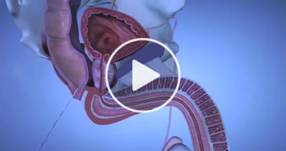 This "Clog" Is The Real Root Cause Of Prostate Problems — One Simple Trick To Fix