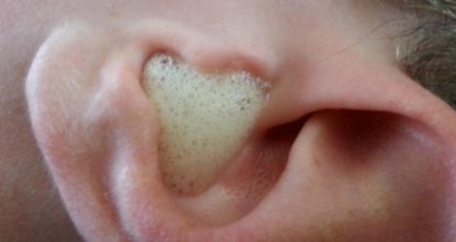 See How This 1-Minute Ritual Can Safely Extract Excess Earwax